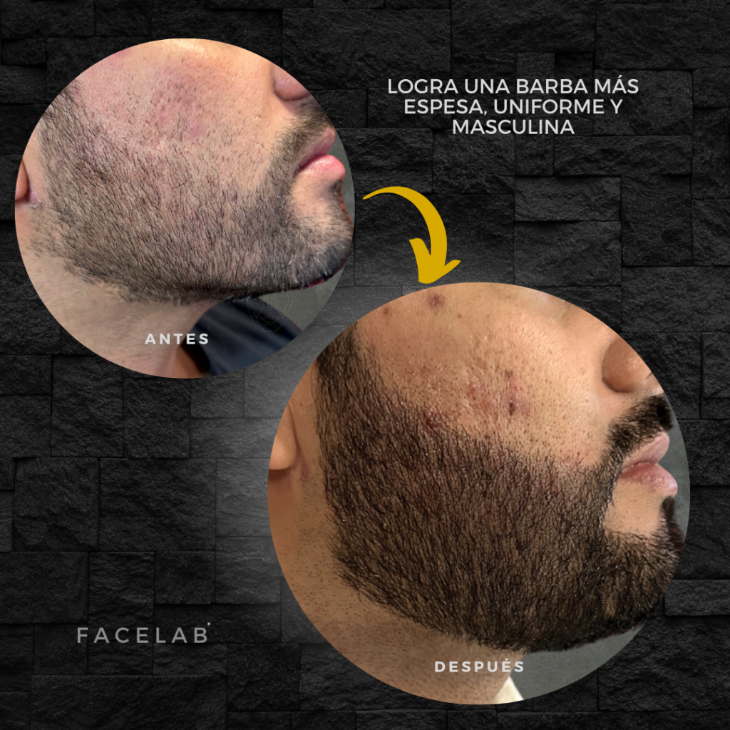 Copia de Sin título (Post para Instagram (cuadrado)) (Historia de Instagram) (Post de Instagram (Cuadrado)) (Historia de Instagram) (Post de Instagram (34)) (8)